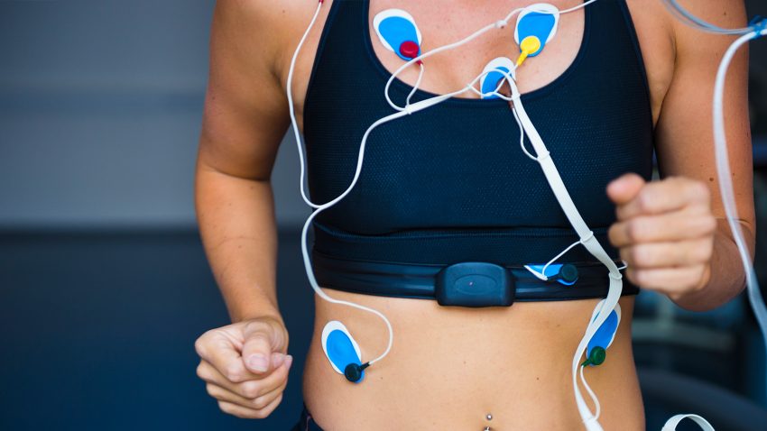 Cardiology Electrodes