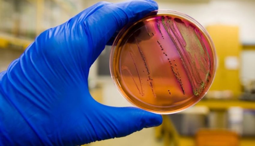 Salmonella Testing Market