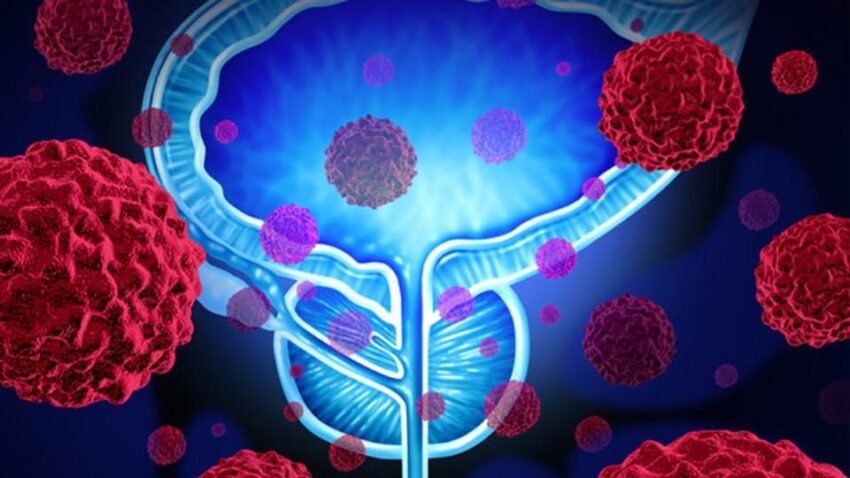 Castrate-resistant Prostate Cancer Market