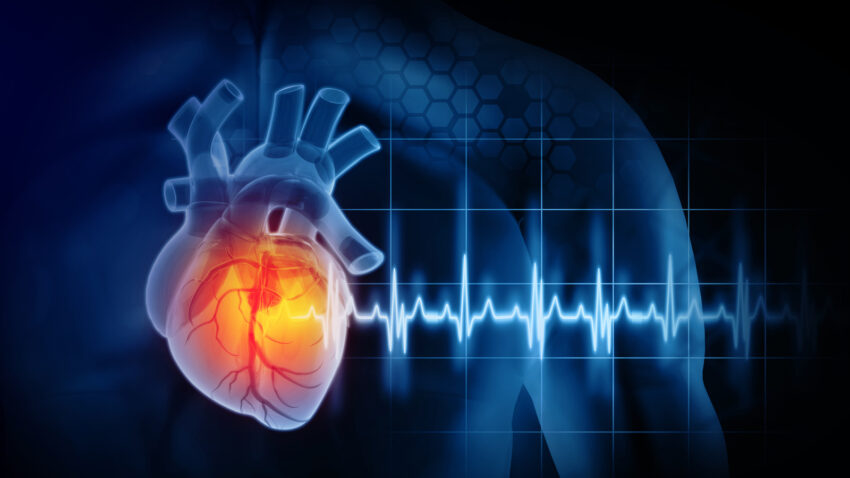 myocardial infarction market over