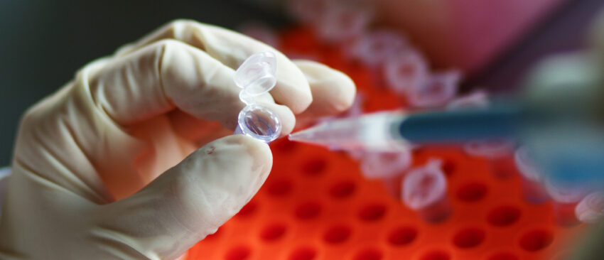 Tissue Plasminogen Activator Market
