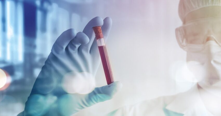 Immunotherapie