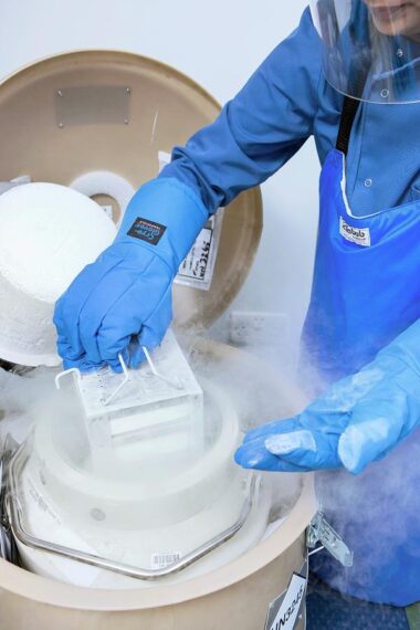Cell Cryopreservation Market