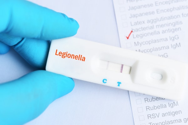 Legionella Testing Market