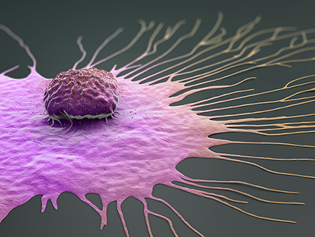 Cancer Cell Migration