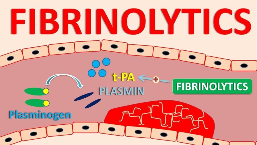 Fibrinolytic Therapy Market1