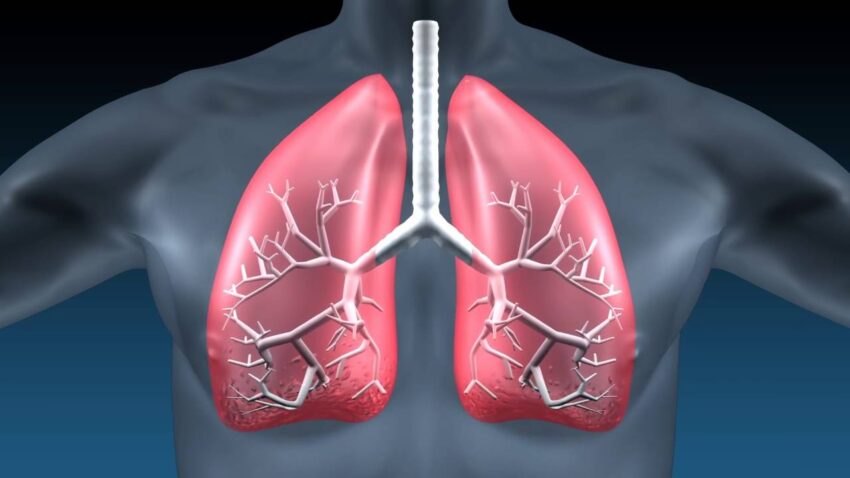 Idiopathic Pulmonary Fibrosis Market