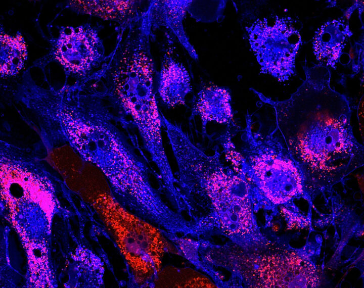 Mesenchymal Stem Cells Market