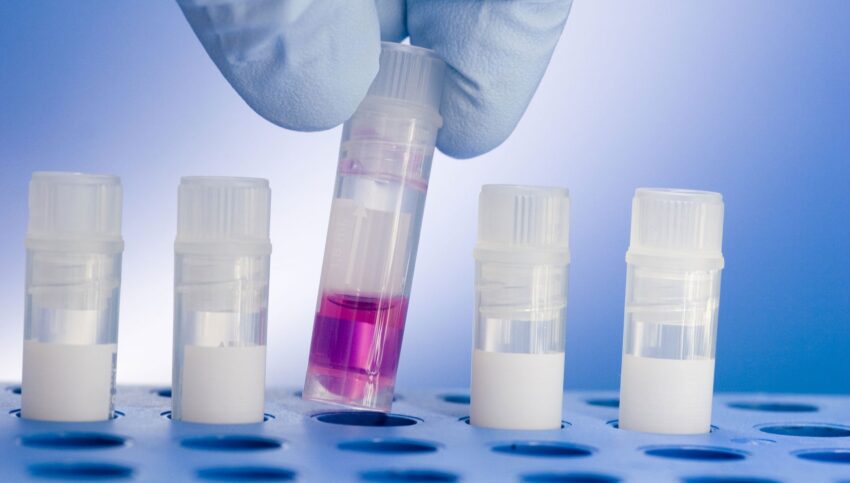 Tissue Banking Market