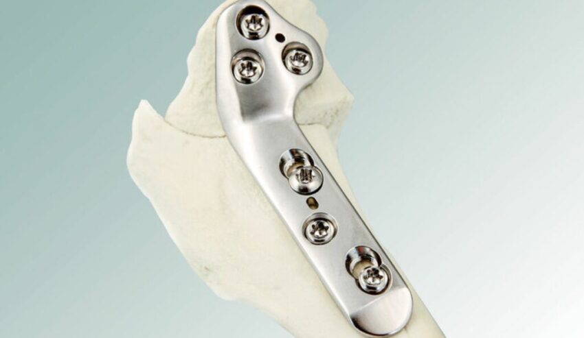 Veterinary Orthopedic Implants Market