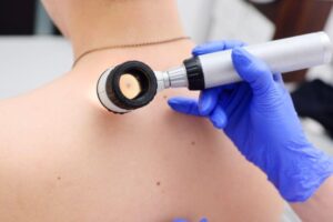 Acute Bacterial Skin and Skin Structure Infections Market 