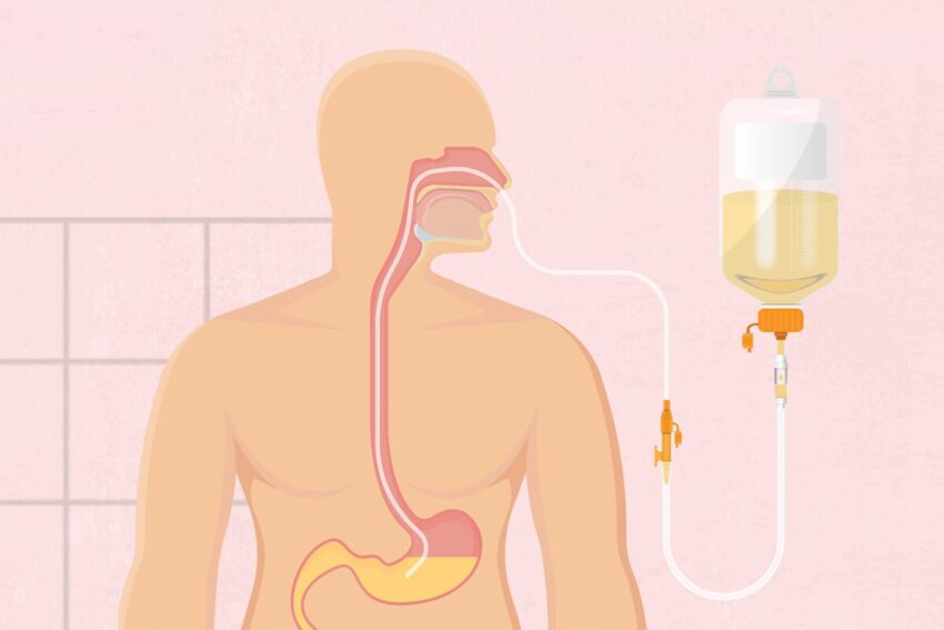 Enteral Nutrition Market