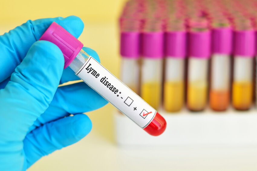 Lyme Disease Diagnostics