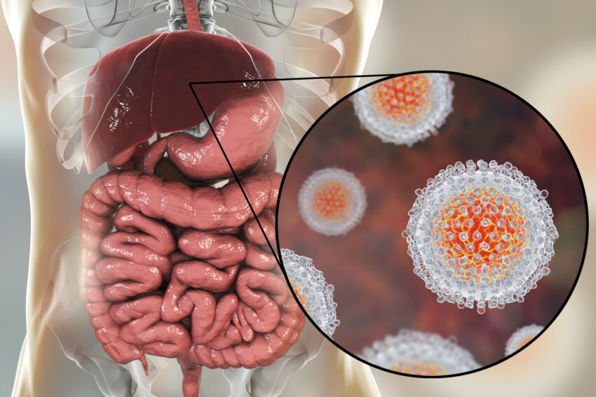 Hepatitis C virus infection medical concept