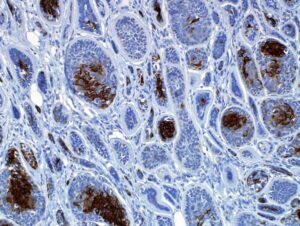 Immunohistochemistry
