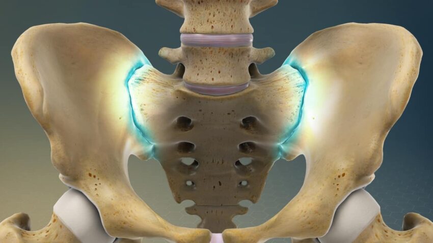 Global Sacroiliac Joint Fusion