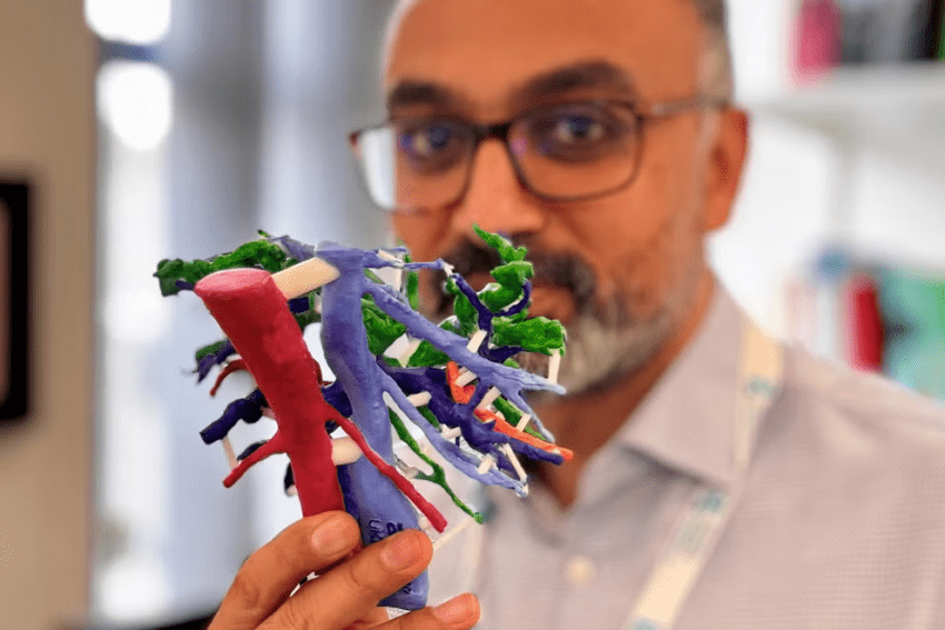 Propensity Score Matching: A Promising Approach for Enhancing Efficiency in Biomarker Discovery from Complex Cancer Research Data