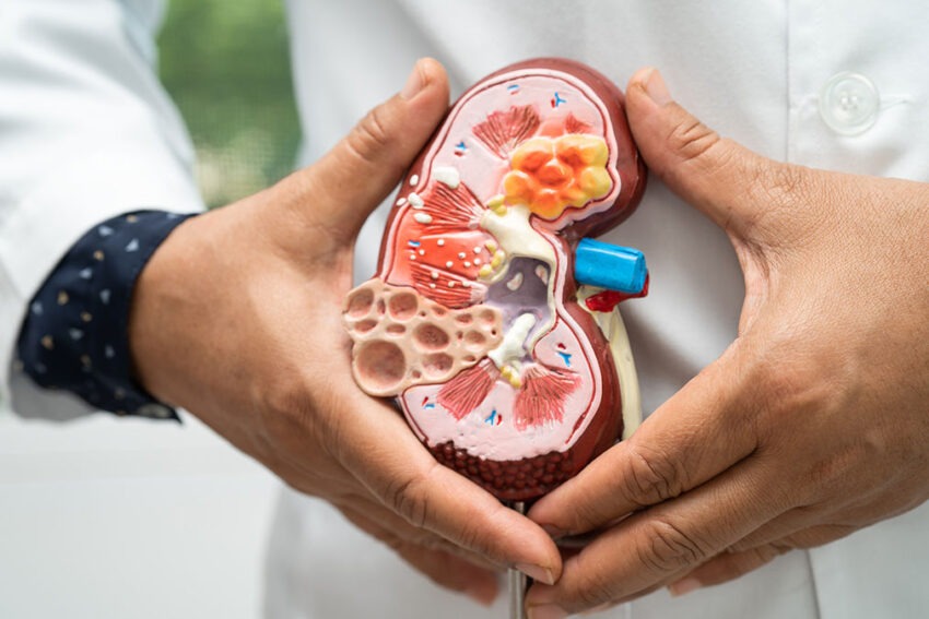 New Gene Discovery May Hold Key to Treating Polycystic Kidney Disease