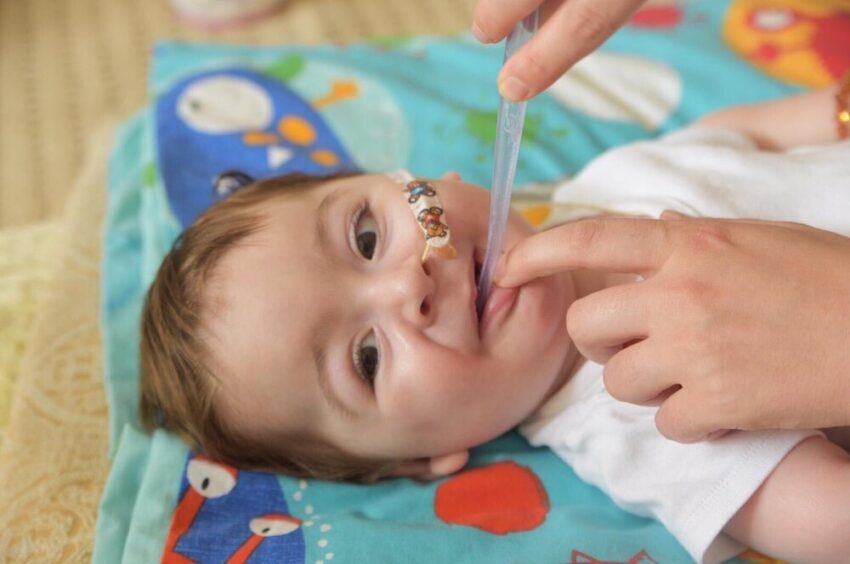 Spinal Muscular Atrophy