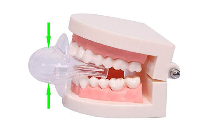 Tongue Retaining Device Market