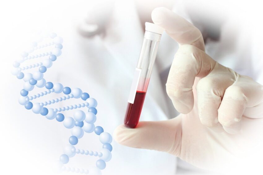 U.S. Hemophilia Treatment