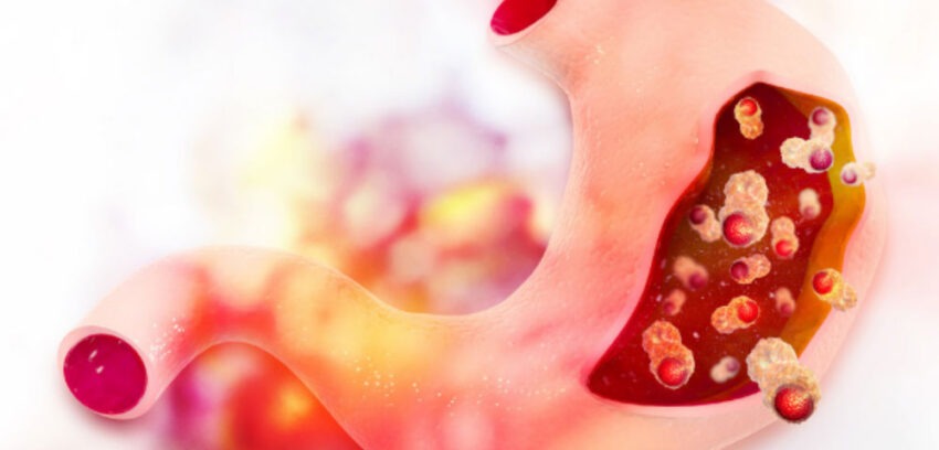 Cancer Therapeutics And Biotherapeutics