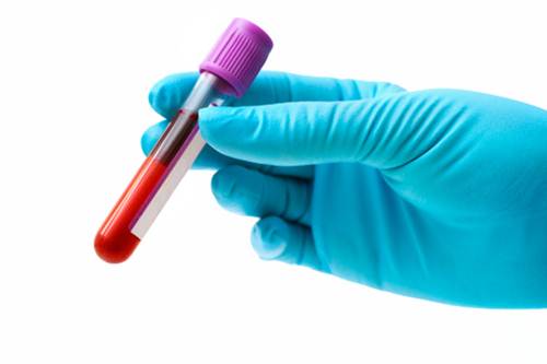 Revolutionary Blood Test
