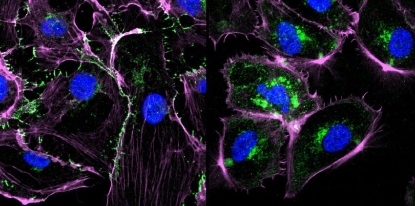 Cell Migration and Cell Invasion Assay