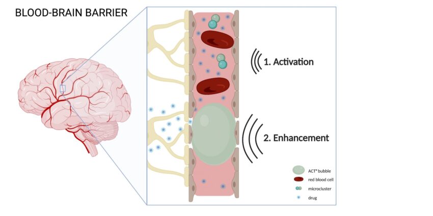 Global Blood Brain Barrier Market