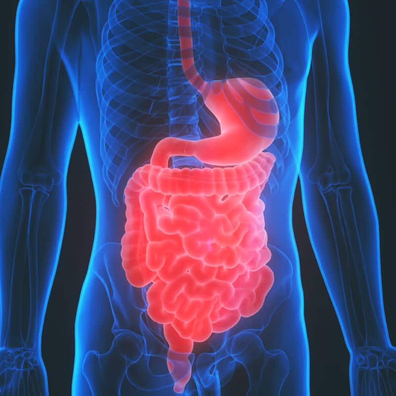 Malabsorption Syndrome
